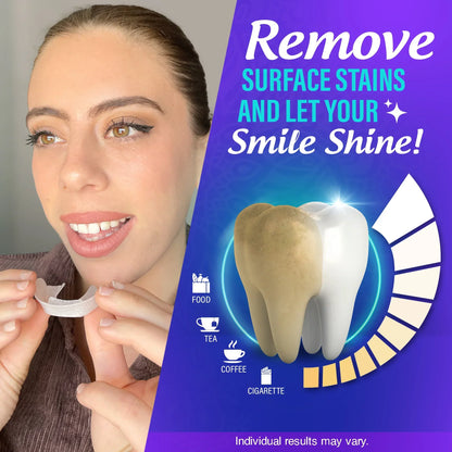 Professional Whitening Trays – 7 Treatments