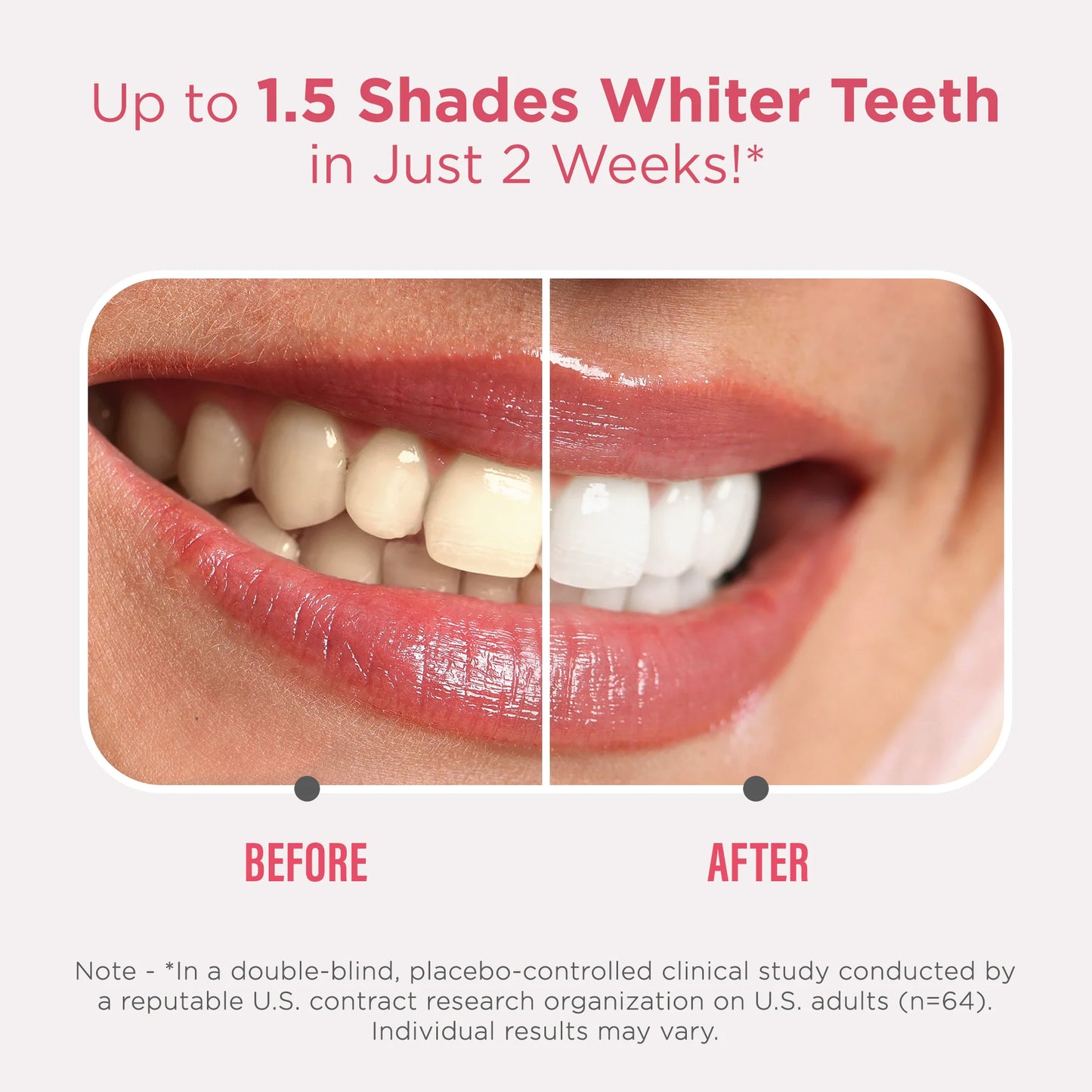 Sensitive Whitening Strips